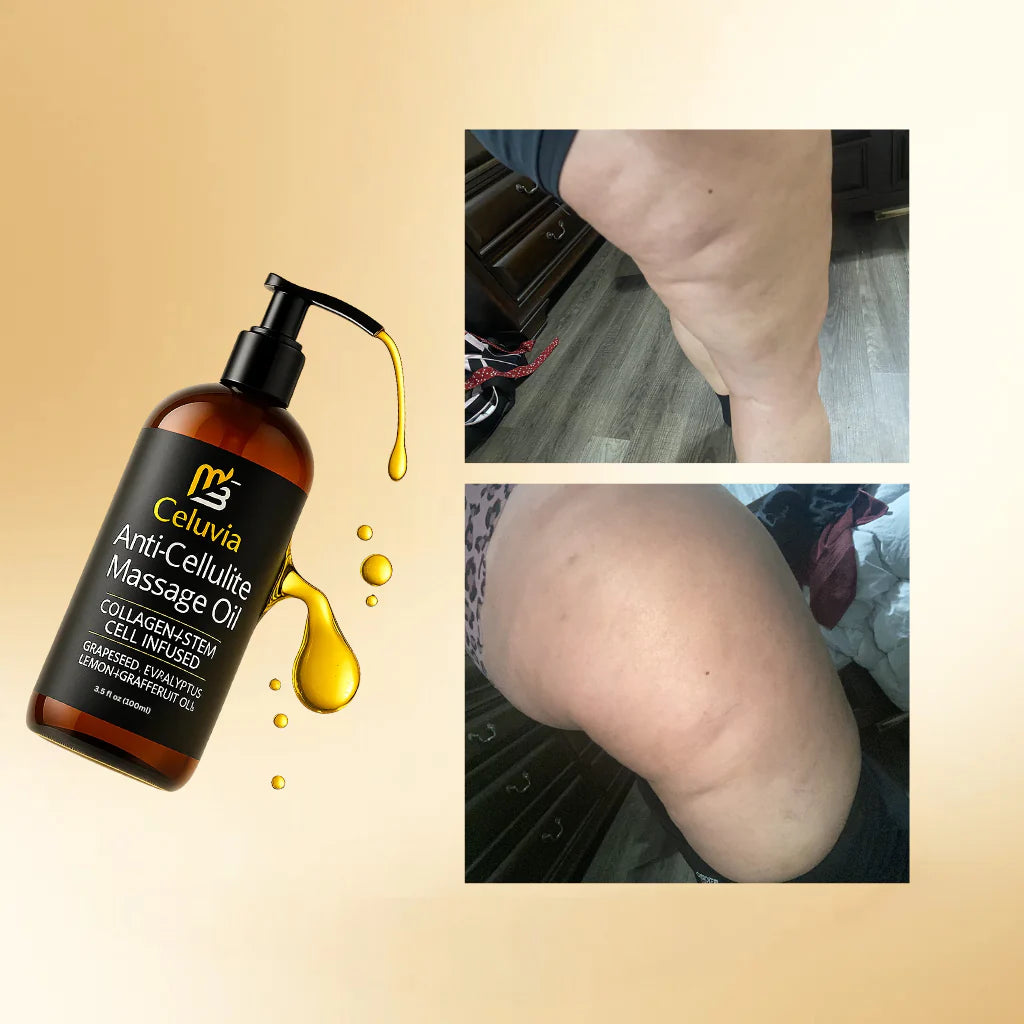 M3Naturals Celulitis Oil massage 250ml
